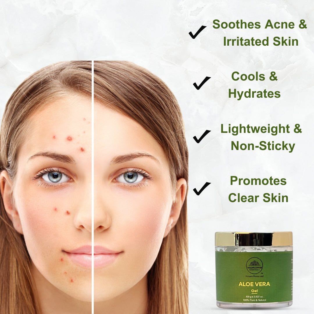 Vitamin E 100ml + Rosewater 100ml + Aloe Vera Gel 100g Combo Wildflower Essentials