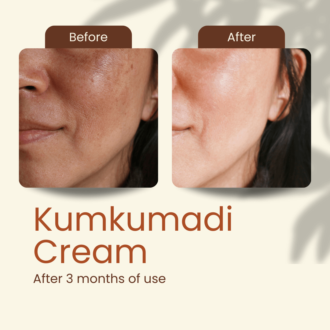 Kumkumadi Cream- Skin Brightening and Whitening Night Treatment | 50g Wildflower Essentials