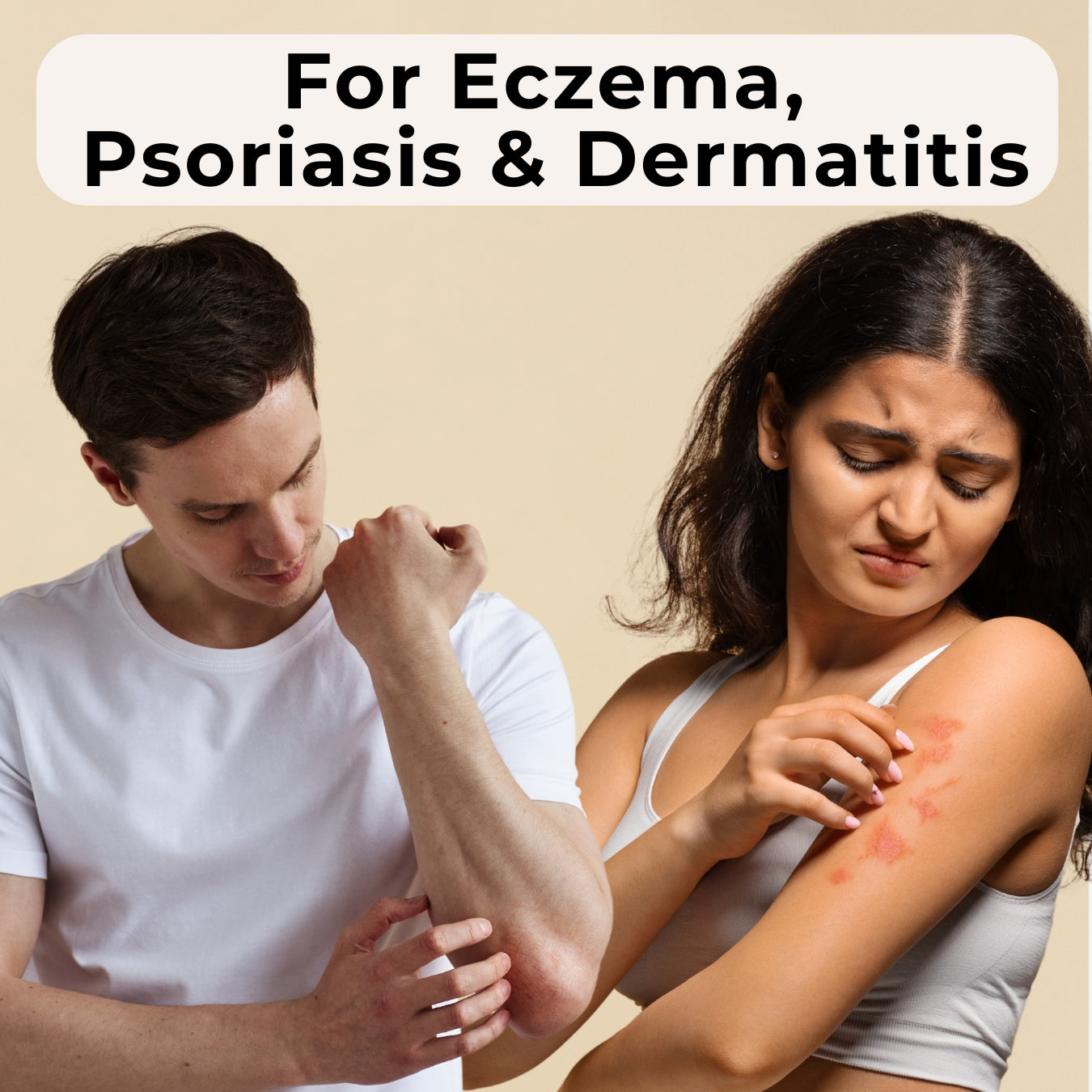 Soothing Oil for Eczema, Psoriasis & Dermatitis | 50ml