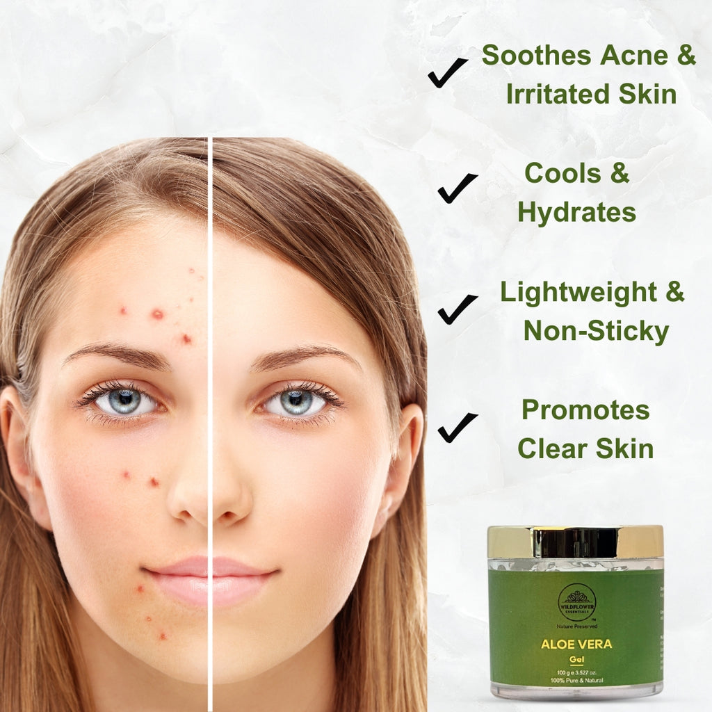 Vitamin E 100ml + Rosewater 100ml + Aloe Vera Gel 100g Combo