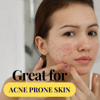 Rosehip / Rosehip Seed Oil Wildflower Essentials