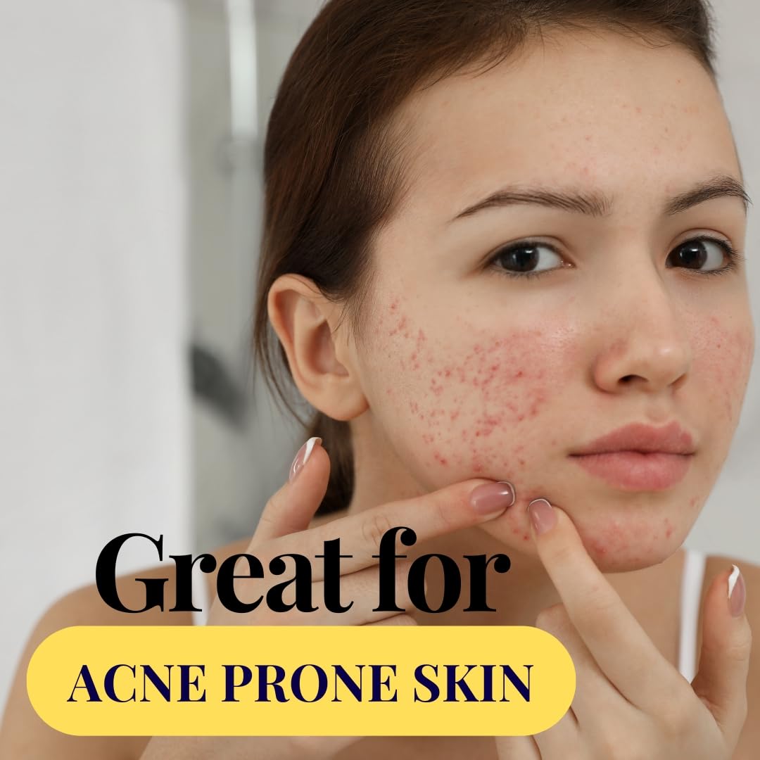 Rosehip / Rosehip Seed Oil Wildflower Essentials