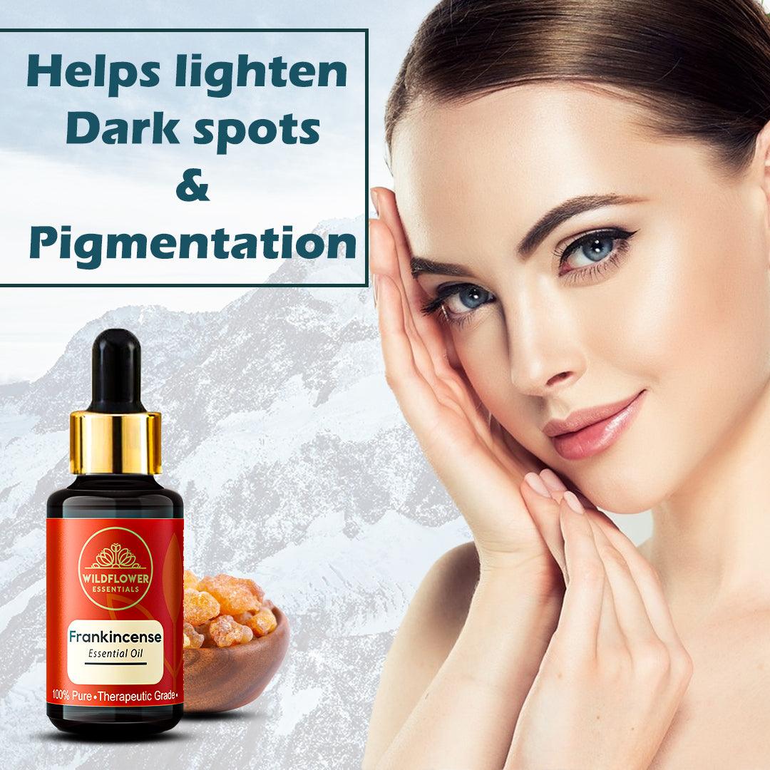 Frankincense Essential Oil